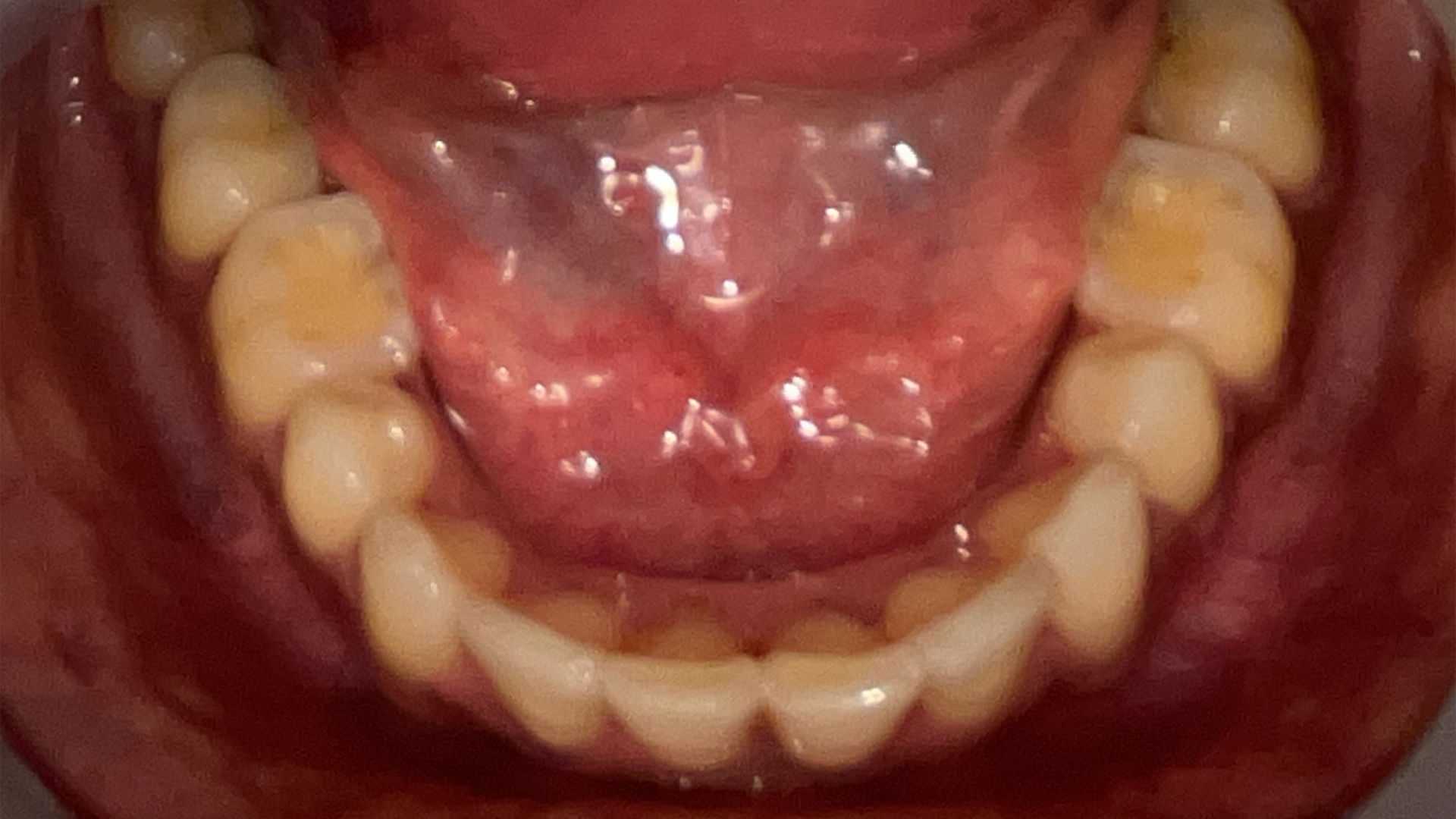 After